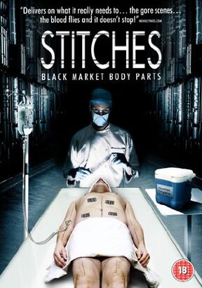 Stitches [DVD] [2008]